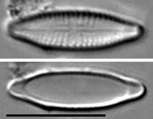 Stauroneis bovbjergii LM6