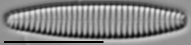 Stauroforma exiguiformis LM1