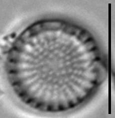 Stephanodiscus minutulus LM4