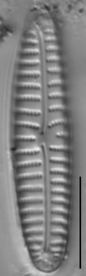 Encyonema appalachianum LM3