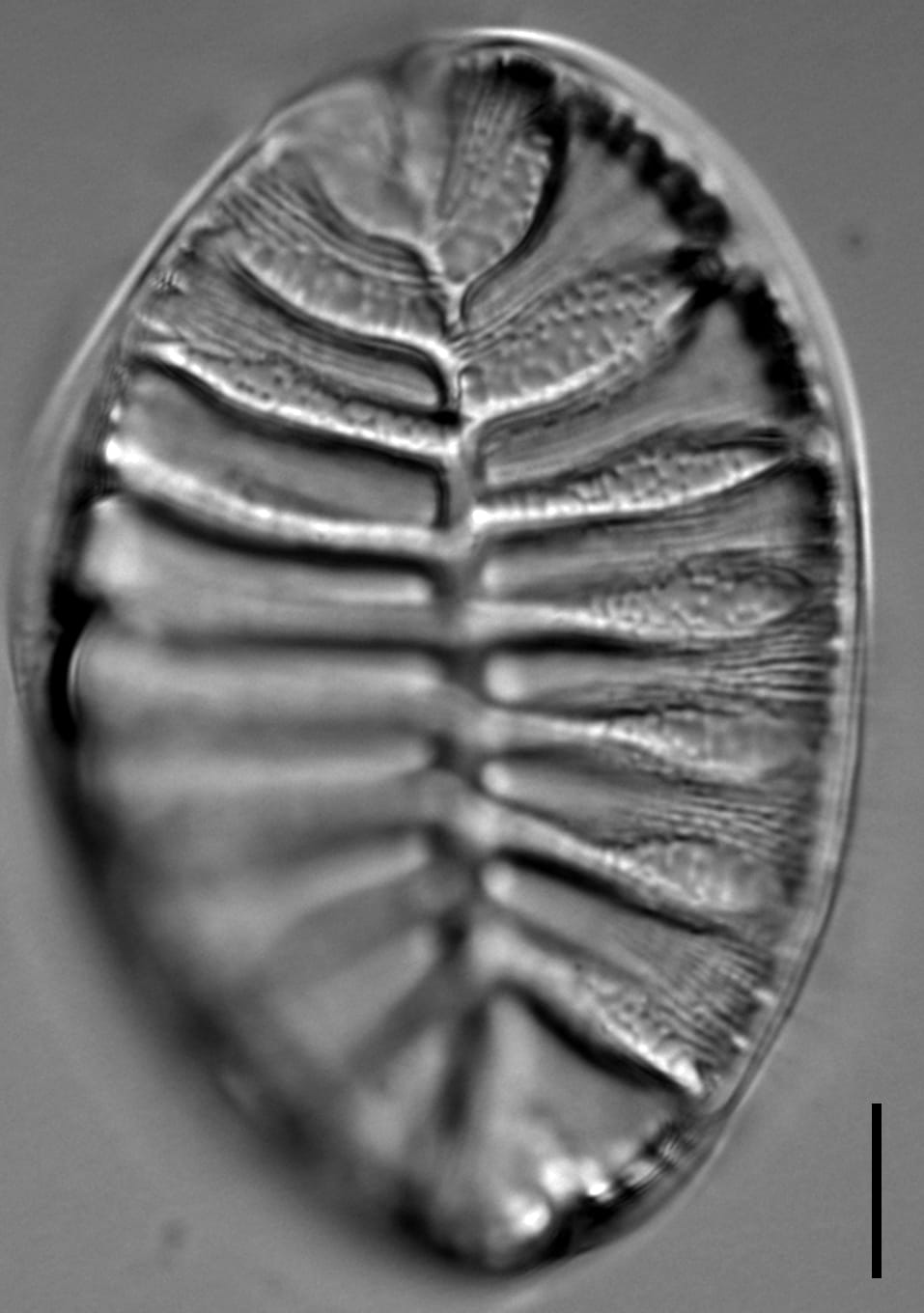 Surirella striatula LM2