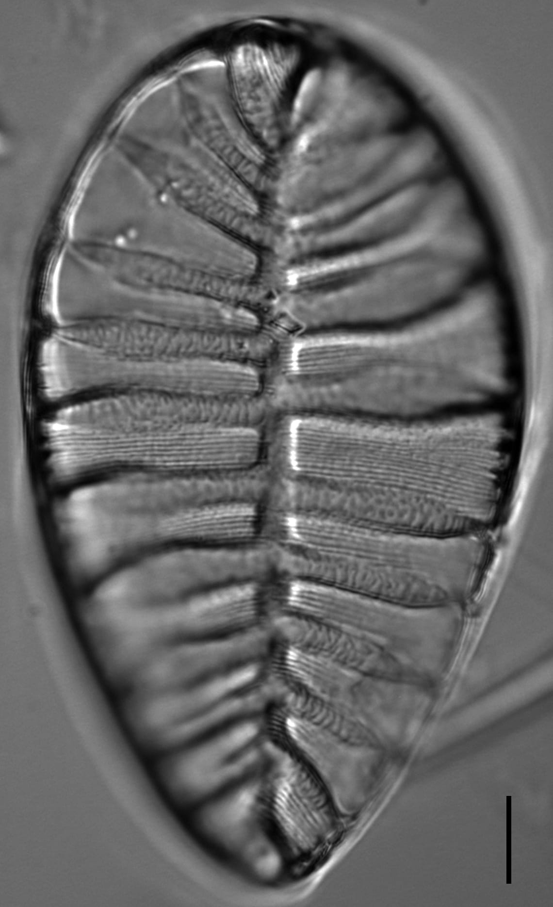 Surirella striatula LM10