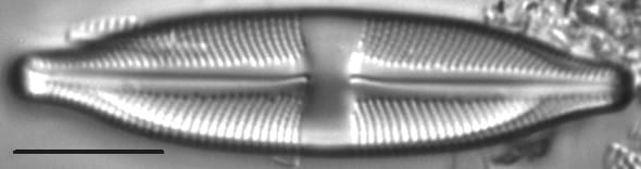 Stauroneis absaroka LM1