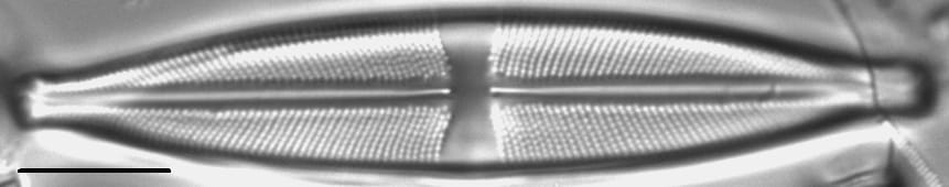 Stauroneis acidoclinata LM5