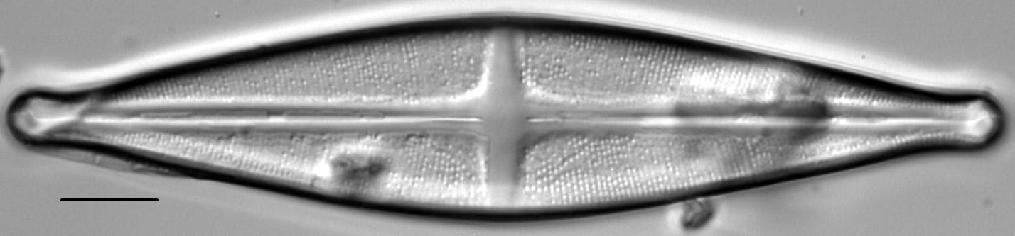 Stauroneis akamina LM6