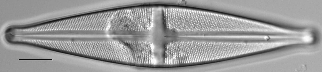 Stauroneis akamina LM5