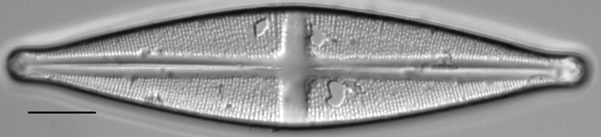 Stauroneis akamina LM4