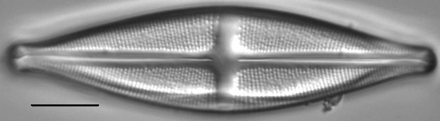 Stauroneis akamina LM2