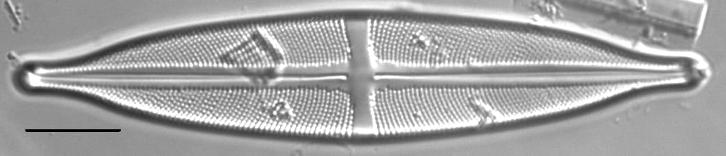 Stauroneis anceps LM7