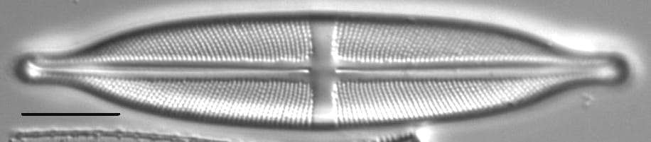 Stauroneis anceps LM3