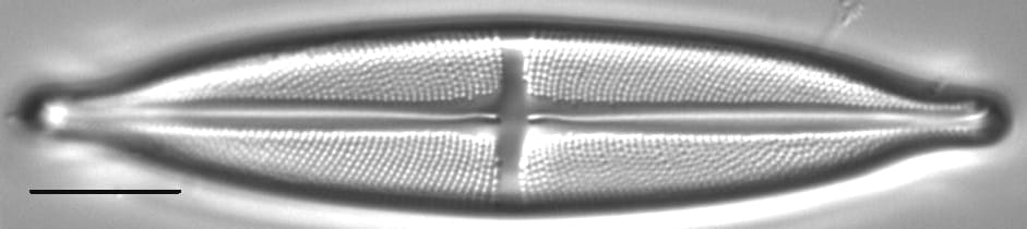 Stauroneis anceps LM2