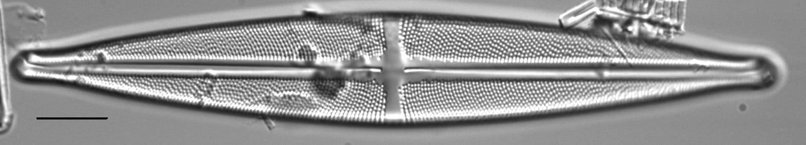 Stauroneis angustilancea LM6