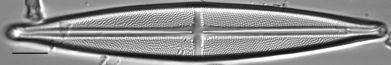 Stauroneis angustilancea LM5