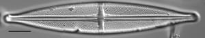 Stauroneis angustilancea LM2