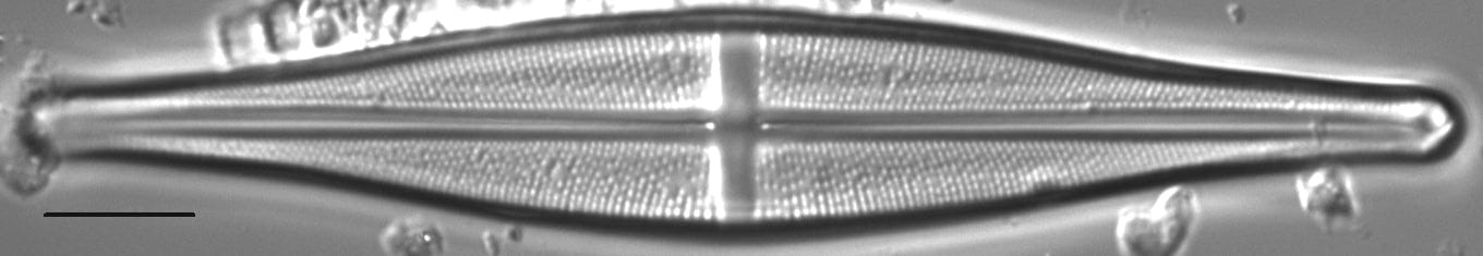 Stauroneis baconiana LM5