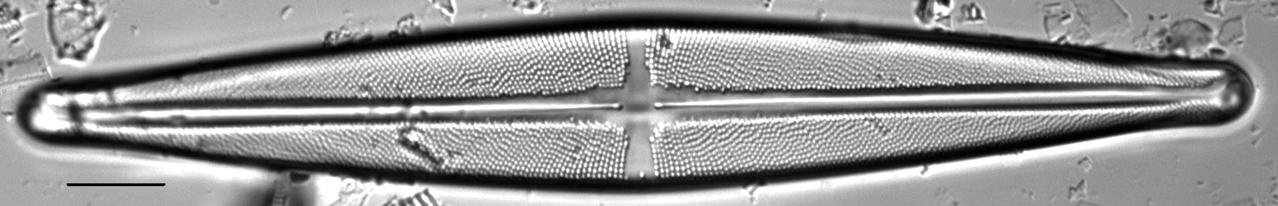 Stauroneis beeskovea LM5