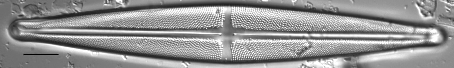 Stauroneis beeskovea LM4