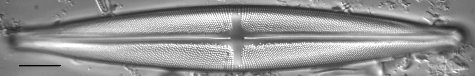 Stauroneis beeskovea LM3