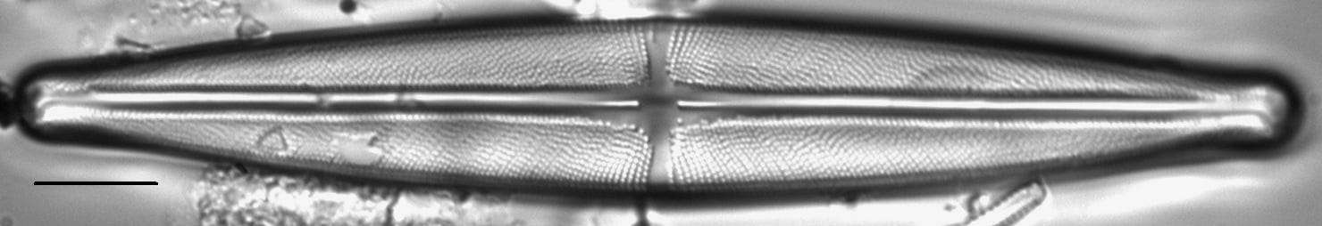 Stauroneis beeskovea LM2