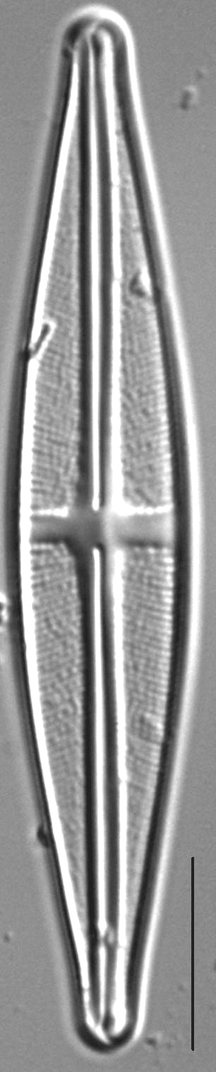 Stauroneis bryocola LM4