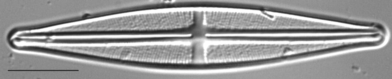 Stauroneis bryocola LM4