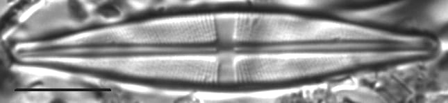 Stauroneis bryocola LM3