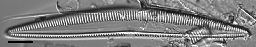 Seminavis eulensteinii LM5