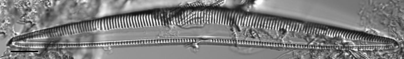 Seminavis eulensteinii LM1