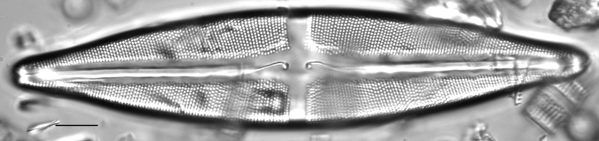 Stauroneis finlandia LM5