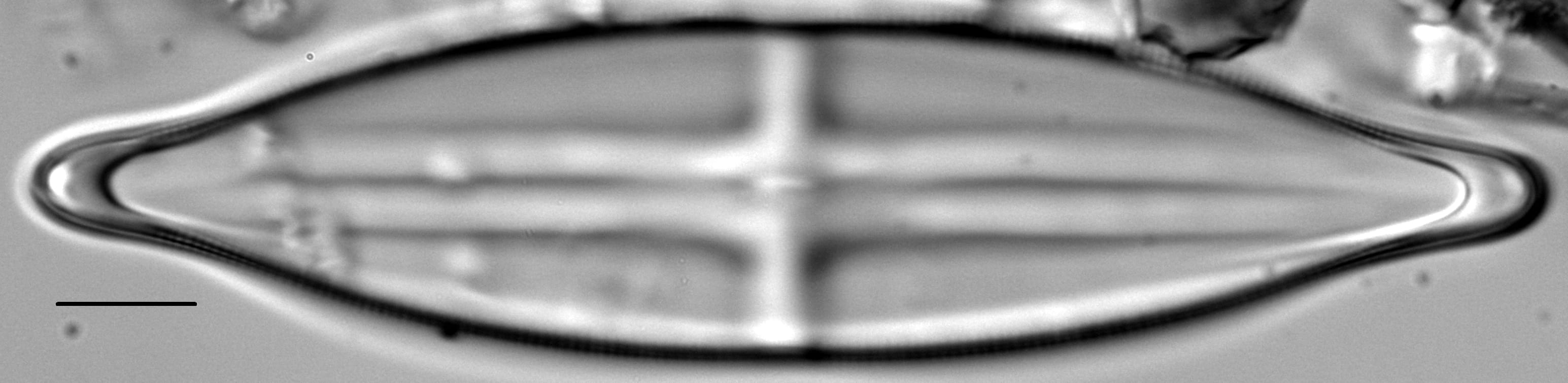 Stauroneis finlandia LM6