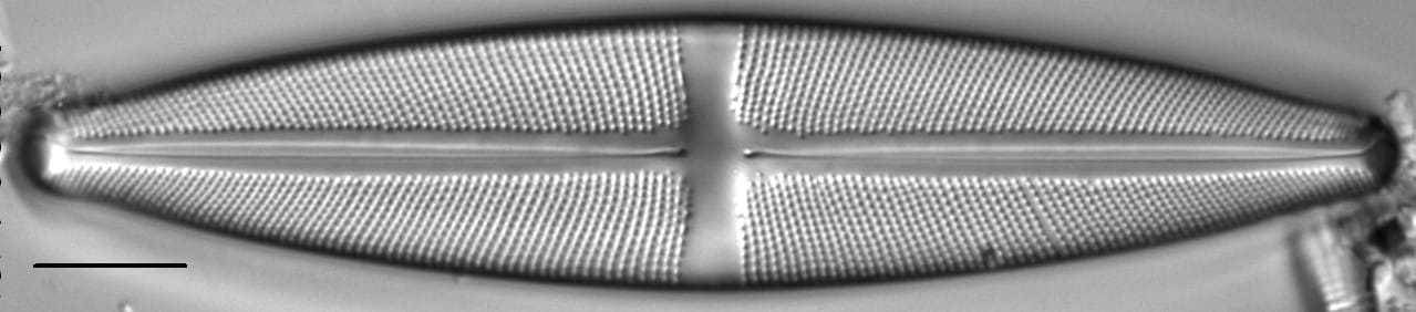 Stauroneis gracilis LM7