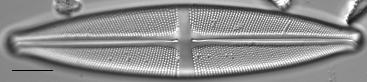 Stauroneis gracilis LM6