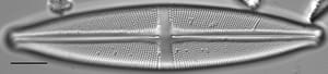 Stauroneis gracilis LM6