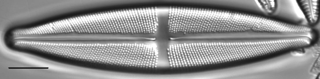 Stauroneis gracilis LM3