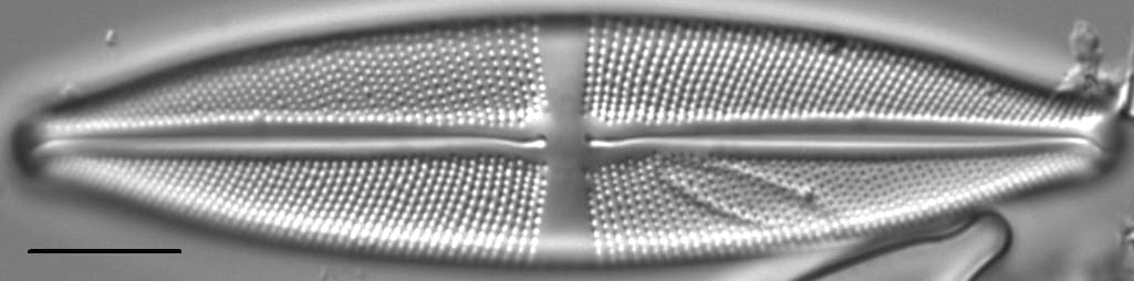Stauroneis gracilis LM2