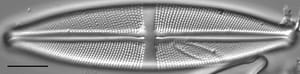 Stauroneis gracilis LM2