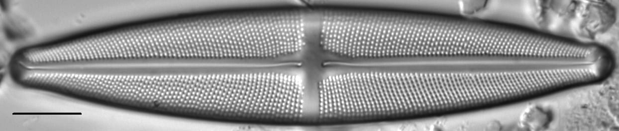 Stauroneis gracilis LM1