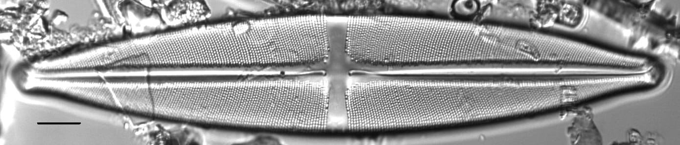 Stauroneis heinii LM5