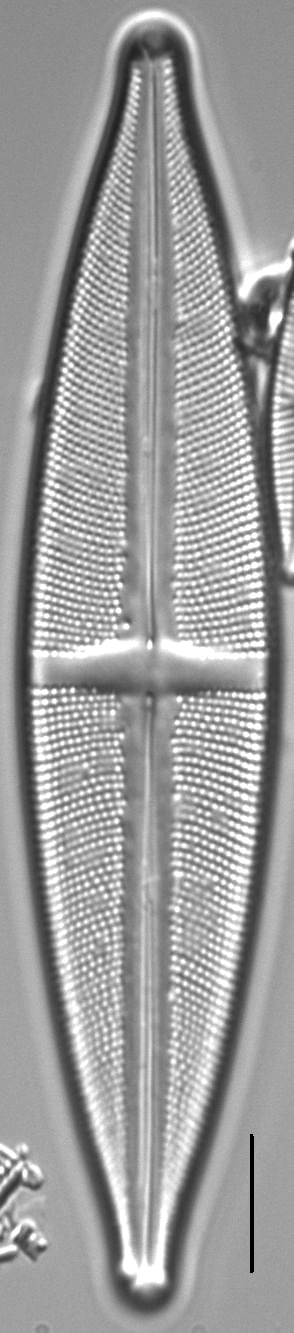 Stauroneis conspicua LM5