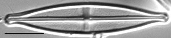 Stauroneis neohyalina LM5