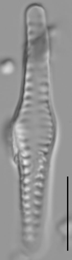 Staurosirella neopinnata LM1