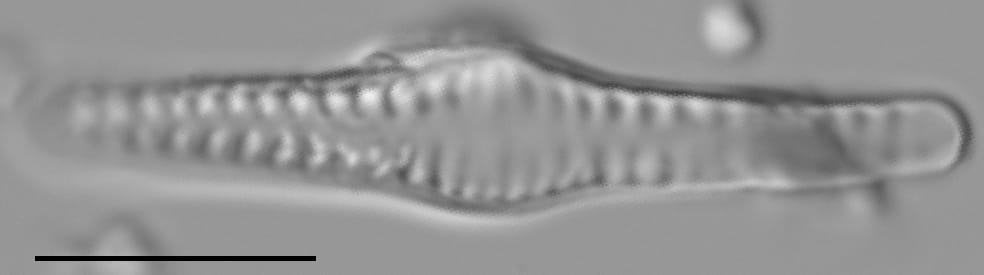 Staurosirella neopinnata LM1