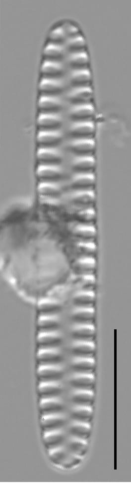 Staurosirella neopinnata LM2