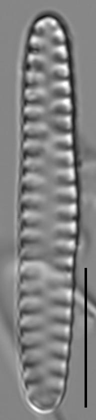 Staurosirella neopinnata LM3