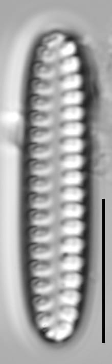 Staurosirella neopinnata LM4