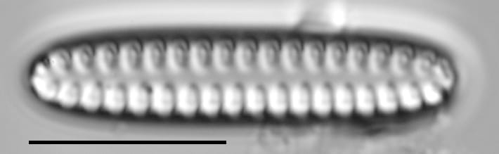 Staurosirella neopinnata LM4