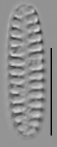 Staurosirella neopinnata LM5