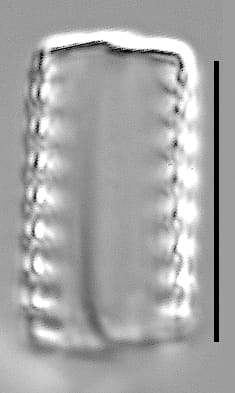 Staurosirella neopinnata LM6