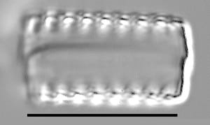 Staurosirella neopinnata LM6