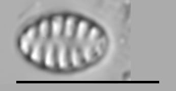 Staurosirella neopinnata LM7
